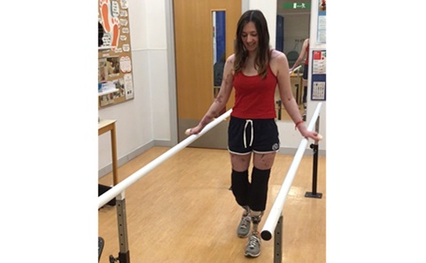Woman in a red vest and black shorts walking on two prosthetic legs, using supportive bars either side of her