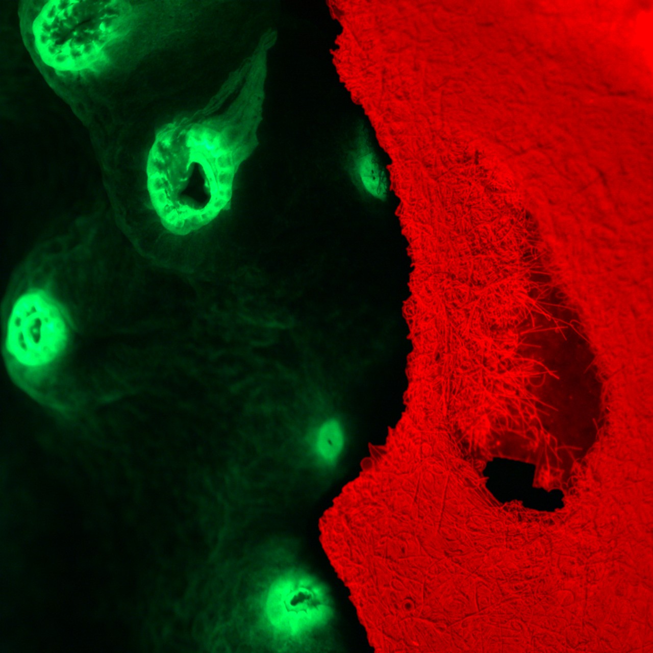 Microscope image of coral disease showing red material on the right and green circular structures on the left.