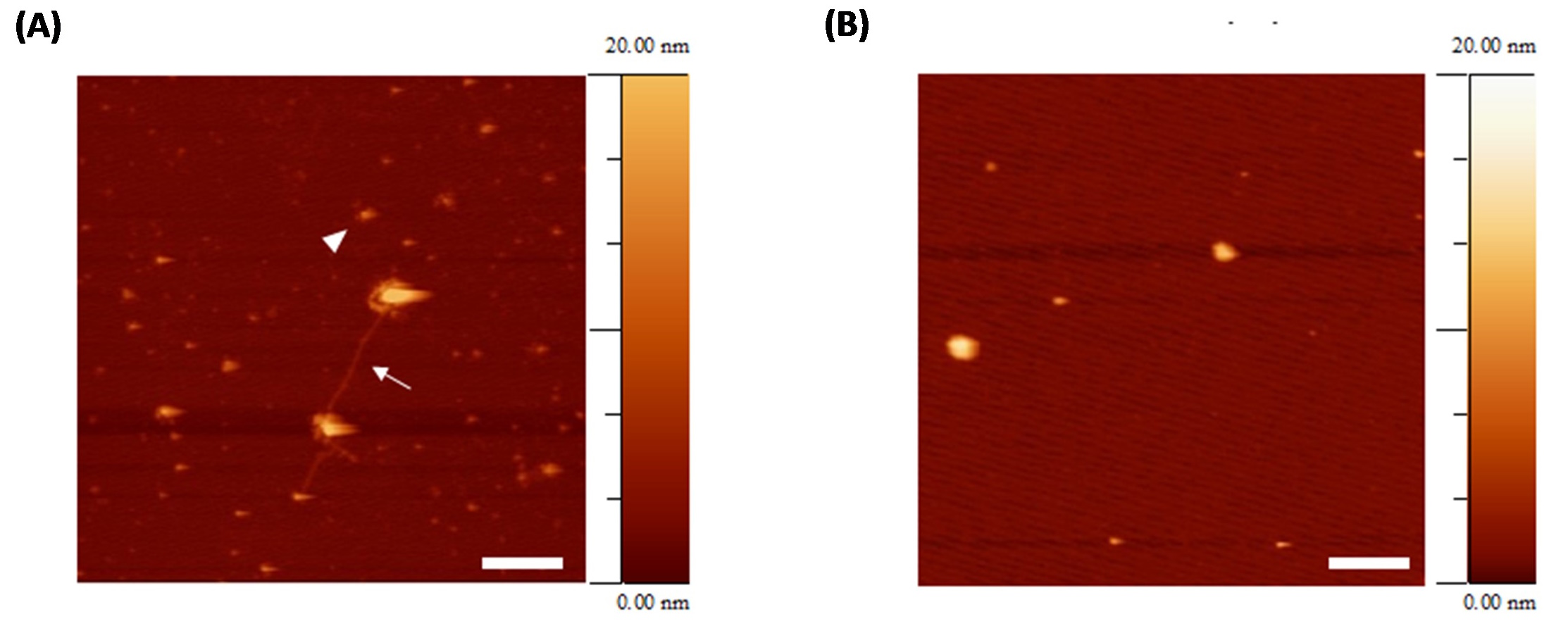 • Scientists used a special imaging technique to observe how Tau protein clumps in the brain tissue of genetically modified flies in response to treatment with RI-AG03. Without the treatment (A), they saw toxic clumps of Tau fibrils (arrow) and oligomers (arrowhead). After treatment (B), those harmful clumps disappeared, and only large round structures remained, which the scientists believe are less harmful.