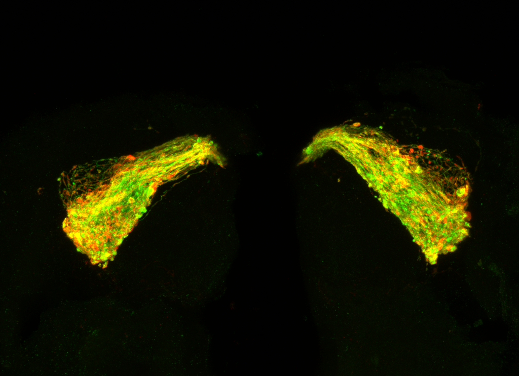 The brain of a 7-day-old fruit fly with Tau expressed in a neuronal circuit used by the fly in olfactory memory. The green outlines the neurons, which are starting to swell and degenerate due to the Tau protein. The red shows where Tau is building up in clusters along the neurons, starting to form the clumps that eventually become rope-like fibrils.