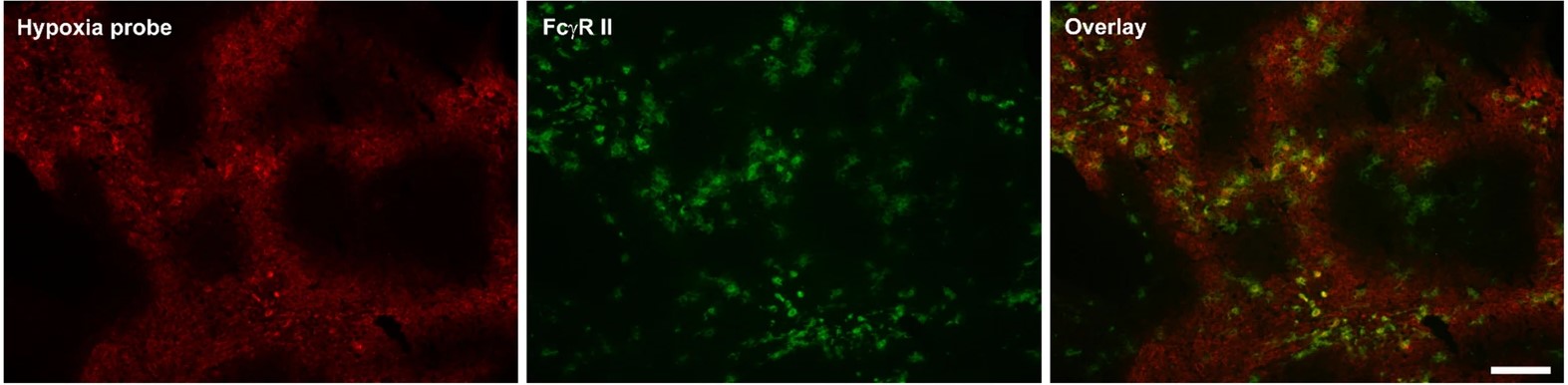 Image alt text placeholder