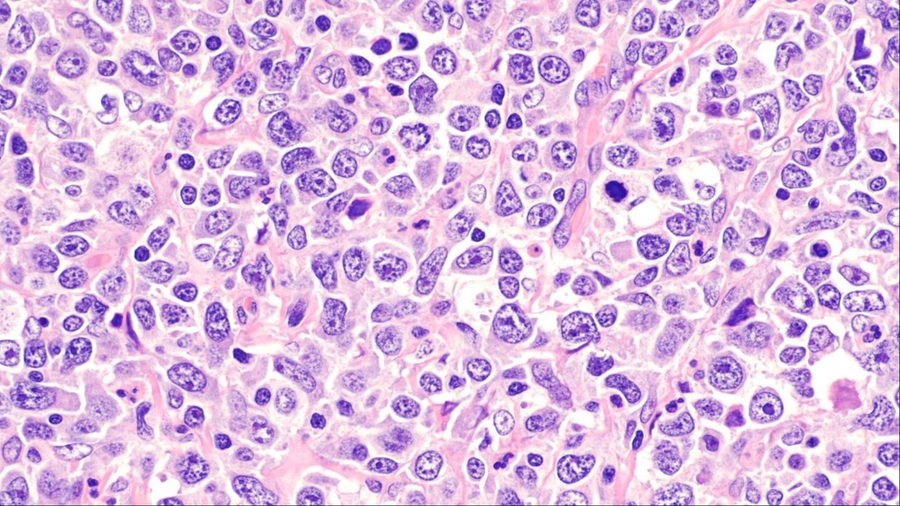 Microscope image of human cells coloured different shades of pink, purple and white.