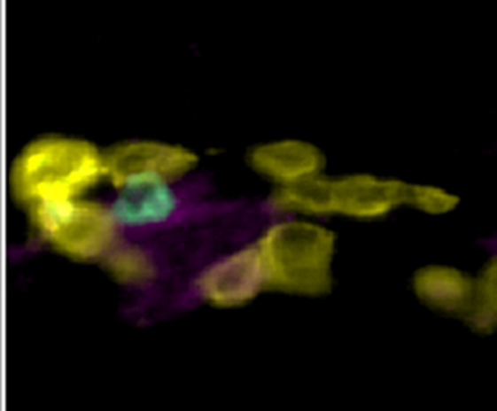 Image alt text placeholder