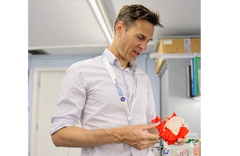 Professor Bulters examines the 3D-printed aneurysm and skull assembly