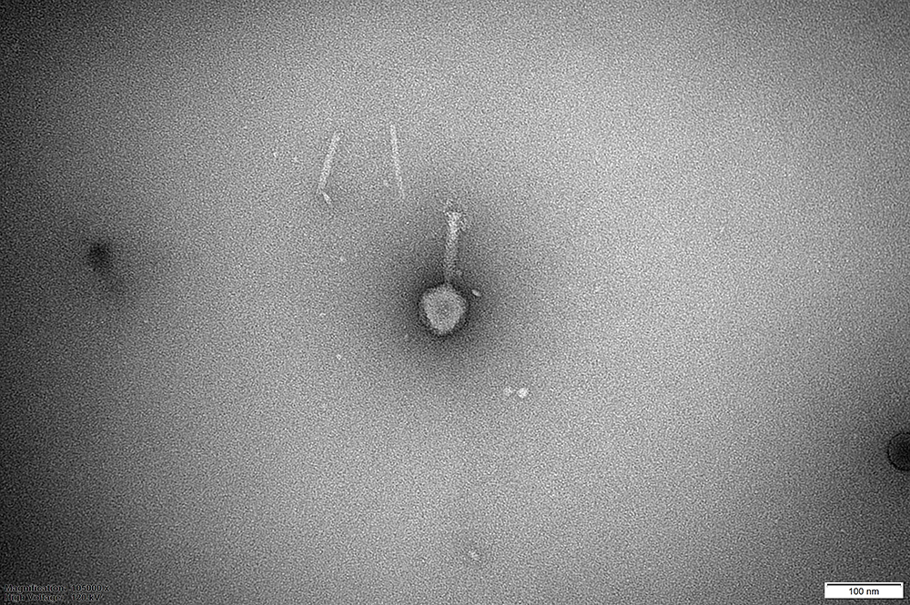  A transmission electron micrograph (TEM) image showing a bacteriophage, an individual virus that infects bacteria. The phage has an icosahedral or polyhedral head (capsid) and a long, non-contractile tail. The scale bar in the bottom right corner indicates 100 nm. The surrounding background is a uniform gray, characteristic of negative staining in TEM.