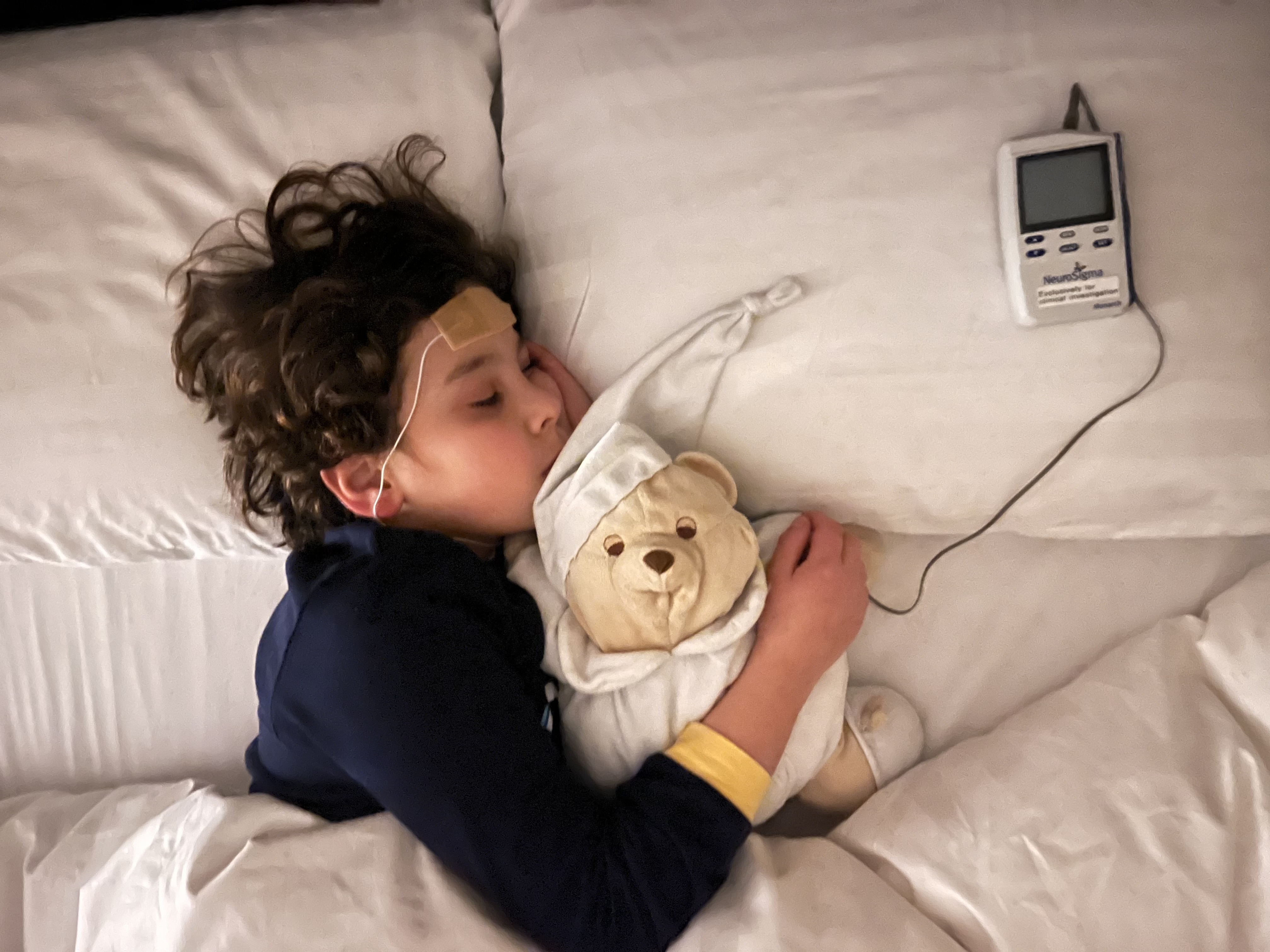 Sleeping child with trigeminal nerve stimulation (TNS) device