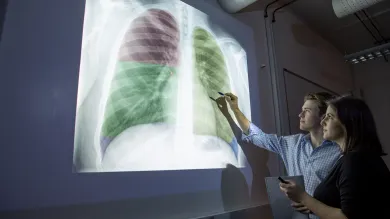 Two students examine an X-ray of human lungs