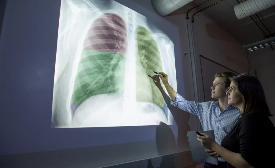 Two students examine an X-ray of human lungs