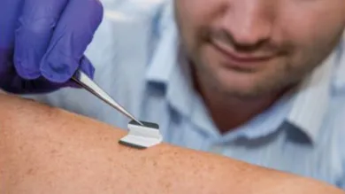 A health researcher swabs a patient's skin