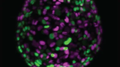Image of a mouse pancreatic organoid, nuclei are labelled in green or purple dependent on cell proliferation status 