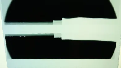 Forensic X-ray