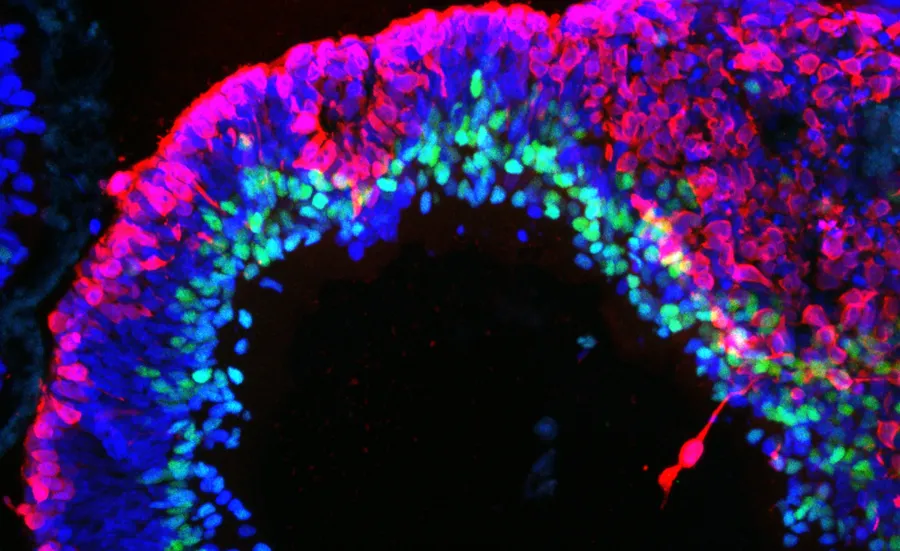 a human stem cell derived retinal organoid stained with antibodies for RECOVERIN (red, =photoreceptors) and AP2 (green, = amacrine cells). The lamination of the tissue and position of the cells is similar to a human retina.