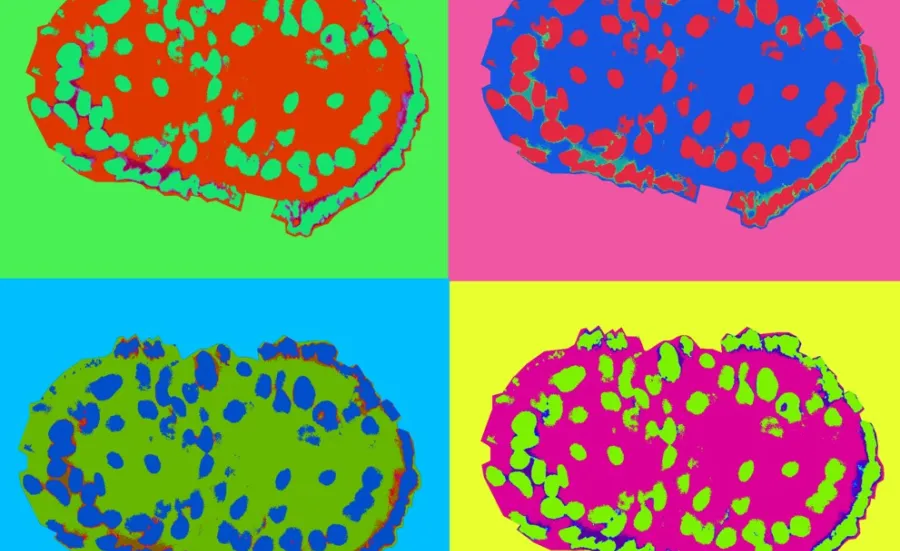 Colourful, pop art style image of a 3D cell culture repeated 4 times in different hues