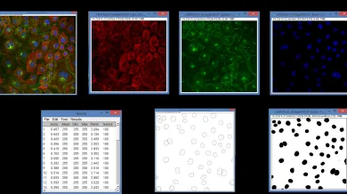 a conceptualization of the process of image analysis
