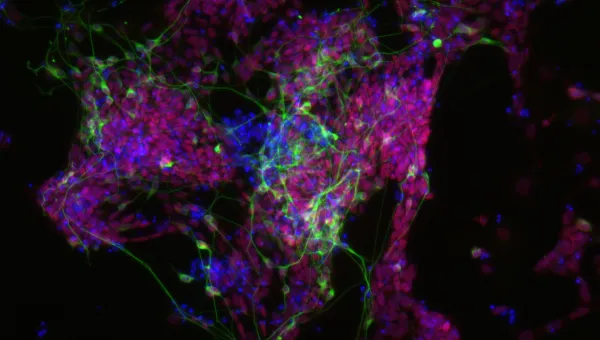 E14 Nuclei Tubb3 Sox1 10 x 0, 10-100microns
