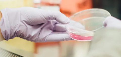 Close-up of a petri dish in a scientist's gloved hands