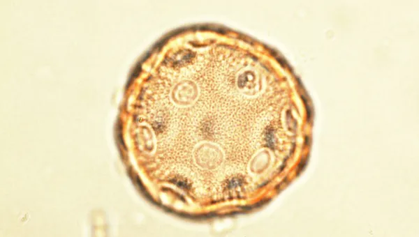 Pollen grain seen under light microscope