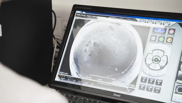 Viewing a microplastic sample in the SEM
