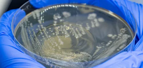 2 gloved hands holding a petri dish with bacteia growing