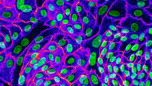 Microscopic image of cells with green nuclei, blue cytoplasm, and red lines.