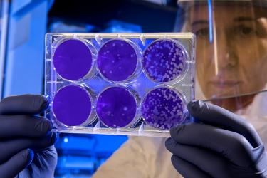 Image of scientist holding petri dishes containing stem cells.