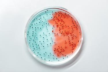 Image showing a petri dish that is half blue and half red, with lots of little black microbes.
