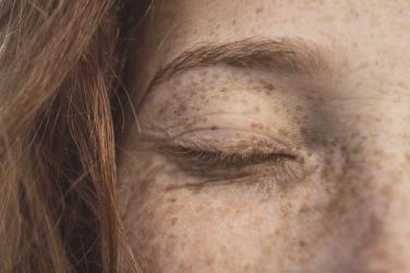 Close up image of a freckled face and one eye, which is closed.  