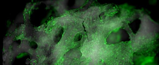 Microscope image of fluorescent cells on trabeculae