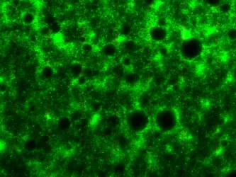 A pseudomonas aeruginosa biofilm, featuring dark circles pockmarking the surface. 