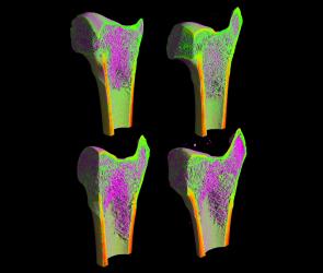 4 Stained femur cross sections