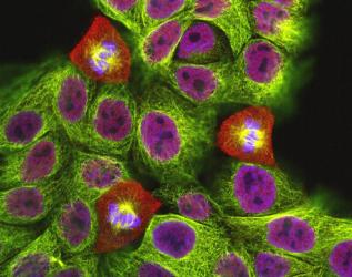 A confocal microscope image of mitotic cells