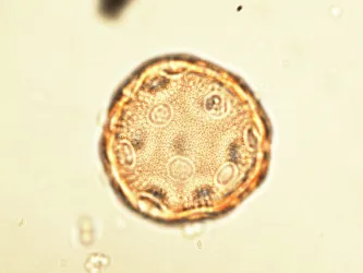 Pollen grain seen under light microscope