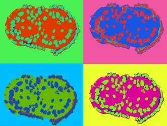 Colourful, pop art style image of a 3D cell culture repeated 4 times in different hues