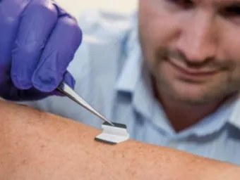 A health researcher swabs a patient's skin
