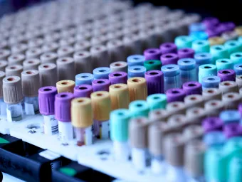 An array of cylindrical medical tubes arranged in multiple rows on a tray. The tubes are capped with different colours, indicating various types of diagnostic tests or additives present.