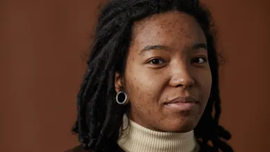 A close-up of a young black woman with acne, wearing a beige turtleneck shirt and looking directly at the camera.
