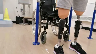Patient wearing prostehtics infront of wheelchair