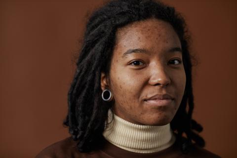 A close-up of a young black woman with acne, wearing a beige turtleneck shirt and looking directly at the camera.