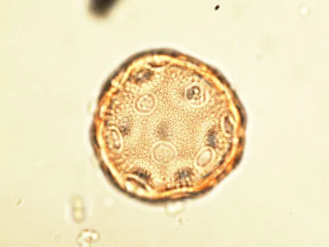 Pollen grain seen under light microscope