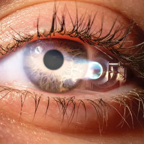 A close-up image of an eye, reflecting a jet propulsion device.