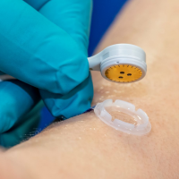 Close up of a skin sensor being placed on a patient's arm